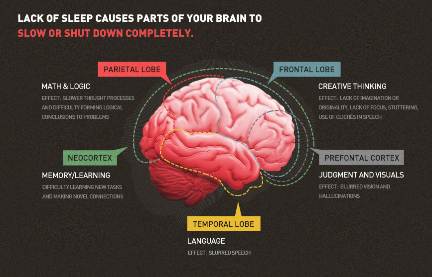 brain-sleep